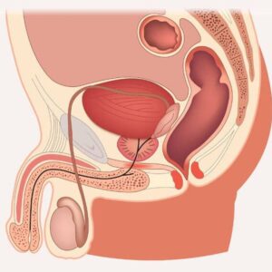 ภาพประกอบบทความนวดกษัย